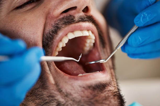 Best Walk-In Emergency Dental Services in Elmwood, IL