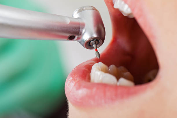 Best Emergency Denture Repair in Elmwood, IL